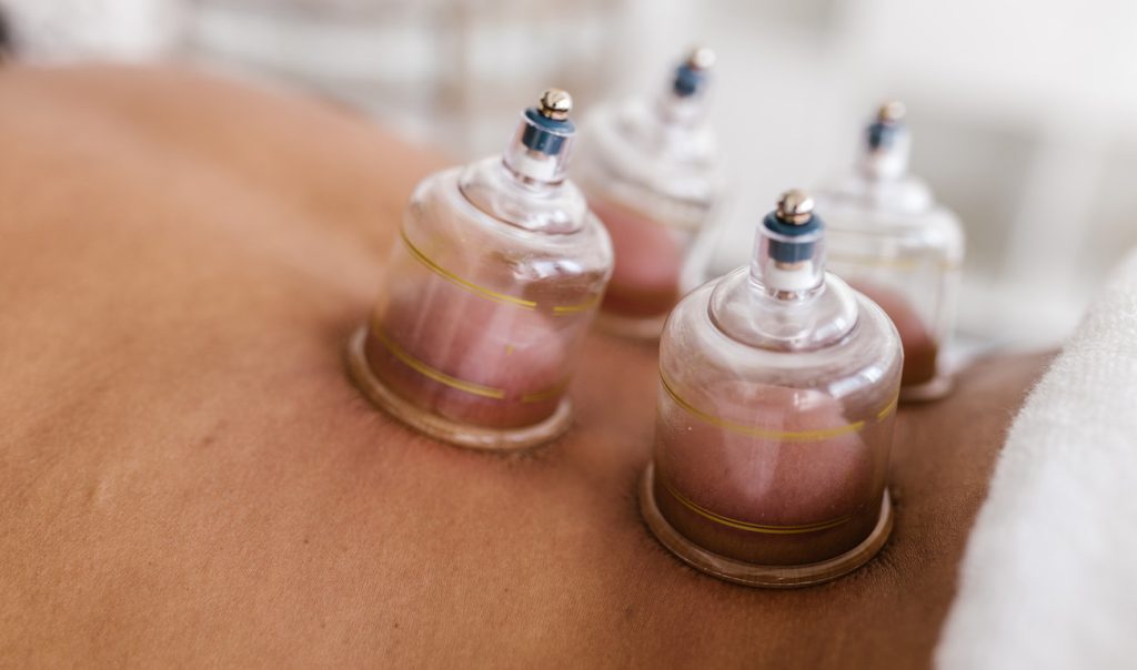 BLAST PIT: Revitalise with Cupping Therapy for Ultimate Wellness